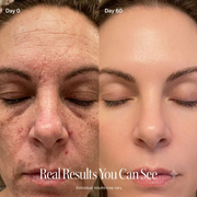 4-in-1 Skincare Wand